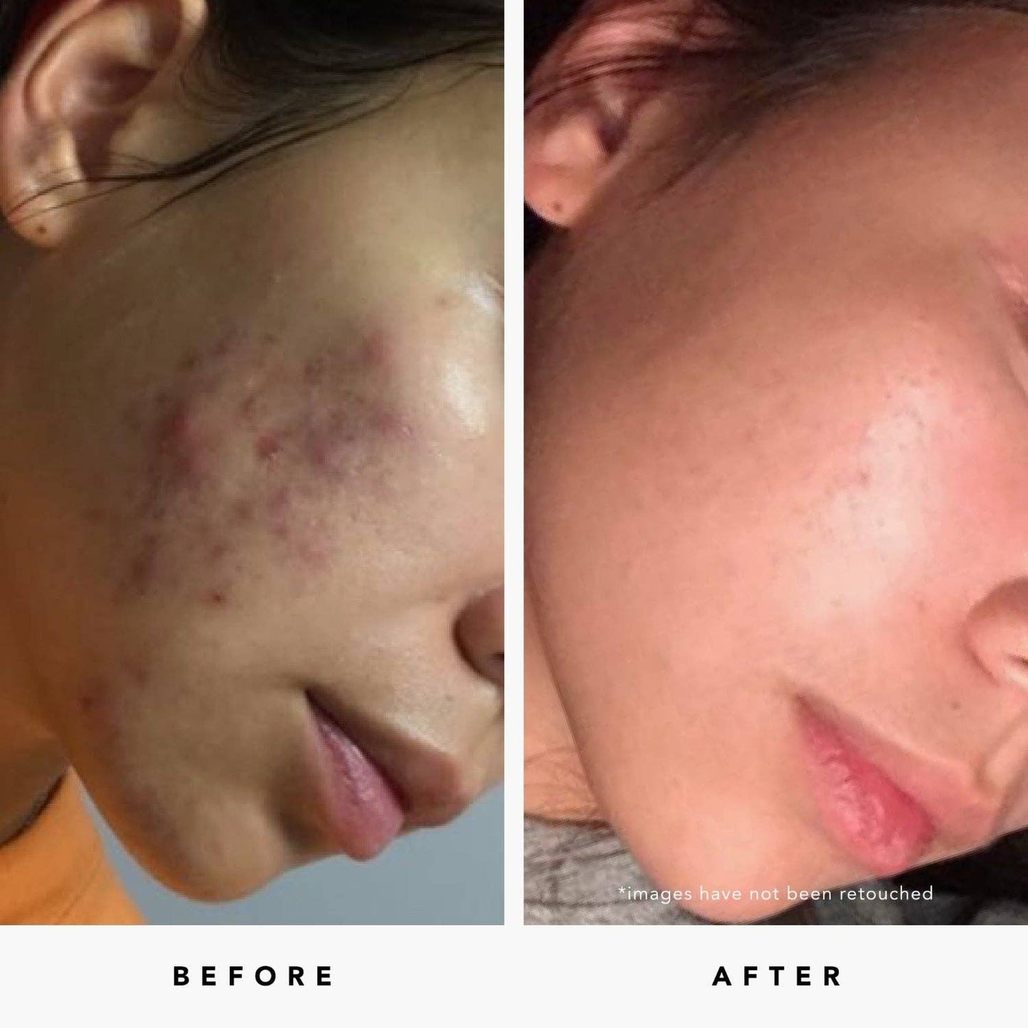 Blue Tansy Invisible Pores Resurfacing Clarity Mask